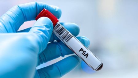 Prostat kanserinde belirtiyi beklemek tanıyı geciktirebilir